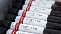 Imagen de Coronavirus: San Antonio sin nuevos casos, pero a la espera del resultado de 10 hisopados