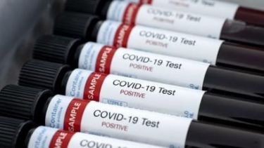 Esta semana, Neuquén sumó 26 nuevos casos confirmados de coronavirus. (Archivo).-