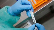 Imagen de Suman 5.246 los muertos por coronavirus en el país