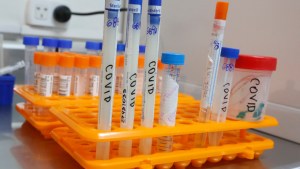 Coronavirus: suman 11.892 las personas fallecidas en todo el país