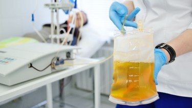 Plasma de la sangre donada por pacientes recuperados.