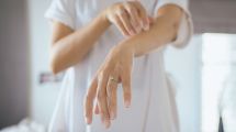 Imagen de Dermatitis atópica: cuando la piel es el principal problema