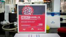 Imagen de Así funcionan los test rápidos de coronavirus que ya se usan en Neuquén