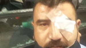 Agredieron a un chofer de colectivo en el Metrobús de Neuquén
