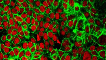  Una de las plataformas en desarrollo permitirá evaluar si un tratamiento servirá para cada paciente, con la tecnología llamada "laboratorio en un chip"
