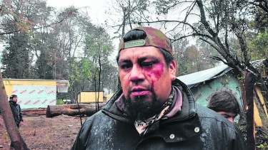 La evidencia de lesiones y daños físicos en el rostro de un hombre, tras el procedimiento policial. Foto: gentileza