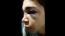 Imagen de Acusan a la policía de golpear salvajemente a un joven y marchan por justicia