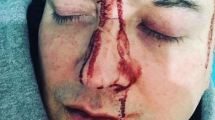 Imagen de Video | Leo García víctima de un salvaje ataque homodiante: «me pegaron por mi sexualidad»