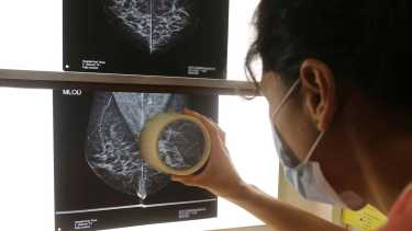 Realizan mamografías gratis en Neuquén por el mes de la sensibilización sobre el cáncer de mama. (Foto Archivo Juan Thomes) 