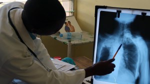 La OMS advirtió que crecieron las muertes por tuberculosis por la pandemia