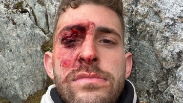 "Cuando me encontraron estaba al borde de la muerte por hipotermia", relató Eitan. 