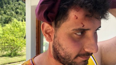 Uno de los jóvenes que fue agredido el viernes en Villa Mascardi. Foto: gentileza