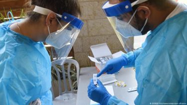Microbiólogos indican que el contagio simultáneo solo se puede detectar si se buscan específicamente ambos virus.-