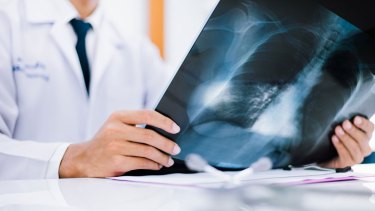 Mueren más de 60 mil personas al año debido a algún tipo de cáncer