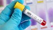 Imagen de Comenzaron las pruebas en humanos de una nueva vacuna contra el VIH
