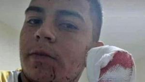 Repartidor tucumano perdió cuatro dedos tras un salvaje asalto con un machete