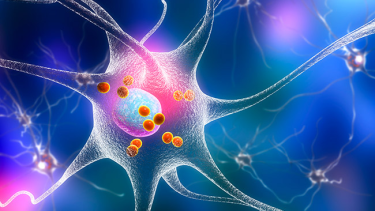Síntomas del Parkinson. Algunos están asociados a la muerte de neuronas que producen dopamina 