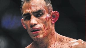 Artes marciales mixtas, ¿carnicería o deporte?