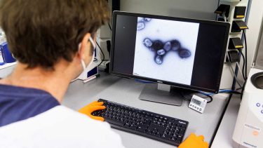 España confirmó 120 casos nuevos de viruela de mono
