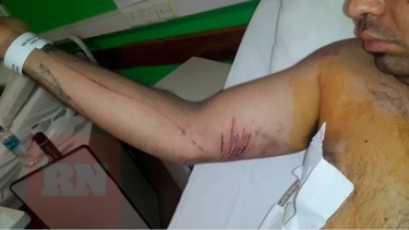 La herida de una de las víctimas, en una foto agregada al expediente. (Gentileza)