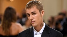 Imagen de Síndrome de Ramsay Hunt, qué es y qué síntomas tiene lo que padece Justin Bieber