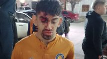 Imagen de Deportivo Roca repudió la agresiones y destrozos en el clásico con Argentinos del Norte