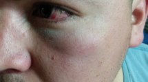 Imagen de Denunció a dos policías por agresiones en la vía pública en el sur de Bariloche