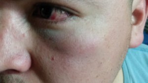 Denunció a dos policías por agresiones en la vía pública en el sur de Bariloche