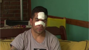 Por el ataque, el joven tiene fisurada la mandíbula, un hueso del cráneo y la nariz. también tuvieron que coserle la frente y debajo del ojo. Foto: Telefé Neuquén