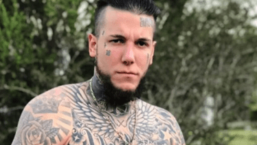 Alex Caniggia sorprendió con la cirugía de mandíbula que se realizó.  