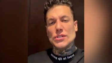 "Me río de los que critican", posteó Alex Caniggia luego del retoque en su mandíbula. 