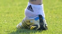 Imagen de La foto viral del tobillo de Messi: ¿lesión o nada para preocuparse?