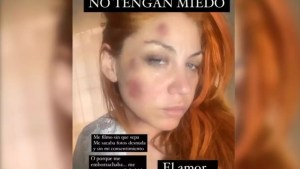 La grave denuncia de Lowrdez, de Bandana, contra su expareja por violencia de género