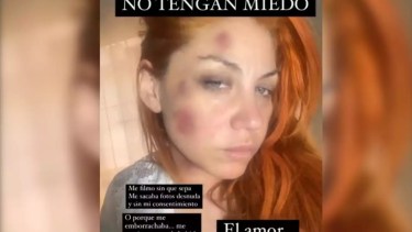 Lowrdez publicó en redes sociales su difícil situación, después de un largo calvario.-