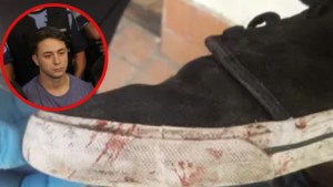 Perito confirmó que la huella en la cara de Fernando fue realizada con la zapatilla que usó Thomsen