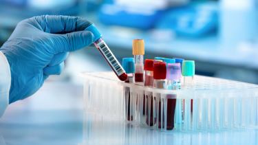 Un test de un hongo mortal está casi listo y es de industria nacional