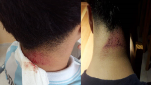 Escuelas inseguras: cayó una placa de yeso sobre un estudiante en San Martín de los Andes