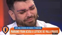 Imagen de Fran Mariano se quebró en vivo al recordar la mala praxis de Aníbal Lotocki: “Me arruinó la cara”