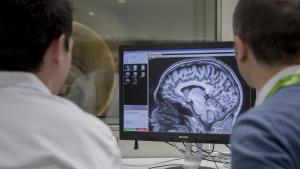 Advirtieron que un «promisorio» fármaco contra el Alzheimer reduce el tamaño del cerebro