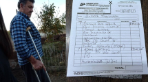 Imagen de Le amputaron la pierna y necesita ayuda para comprar una prótesis en Regina
