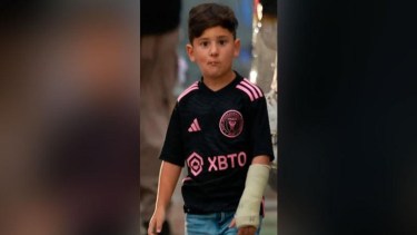 Ciro Messi lleva algunas semanas de recuperación, con un yeso en su brazo izquierdo.-