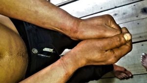 Detuvieron a dos policías de Misiones por torturar a un joven de 23 años: «Eso no nos gusta»
