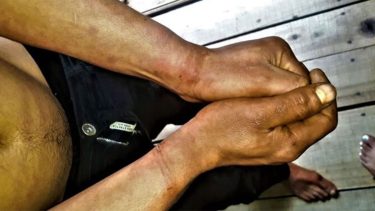 Detuvieron a dos policías de Misiones por torturar a un joven de 23 años: «Eso no nos gusta»