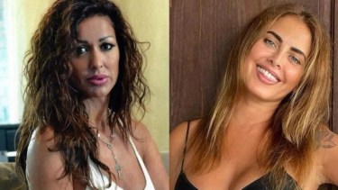 Pamela Sosa también tiene aplicado metacrilato, como Silvina Luna.-
