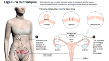 Imagen de Cada vez son más las jóvenes que optan por la ligadura de trompas