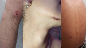 Denuncian golpiza de policías a un grupo de jóvenes en Junín de los Andes: «Sentían que morían»