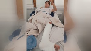 Sumate: Joaquín se quebró en el Mundialito y necesita tu ayuda para una operación