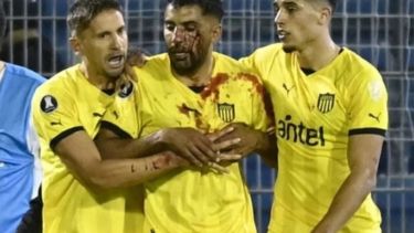 Maximiliano Olivera, herido en el campo de juego. Después se desvaneció en el vestuario.