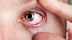 ¿Ojos secos? Cinco ejercicios muy fáciles para combatir la fatiga visual y el dolor al parpadear