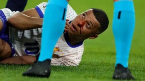Video | Preocupación en Francia por Mbappé: terminó ensangrentado y fue reemplazado